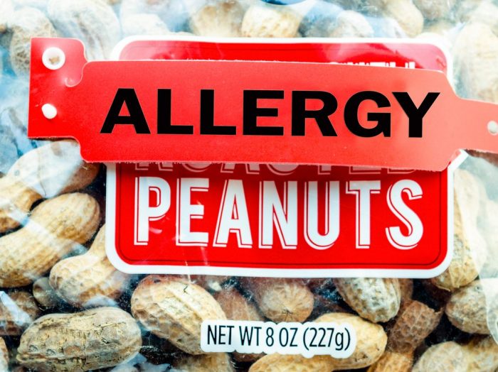 Food Allergies – Why Are They Increasing?